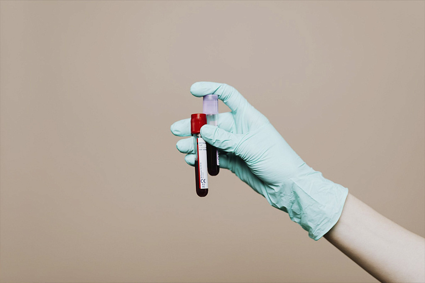Photograph of medical tubes held by a gloved hand for iron deficiency diagnosis